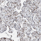 Immunohistochemical staining of human placenta shows moderate to strong nuclear positivity in trophoblastic cells.