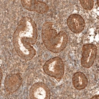 Immunohistochemical staining of human endometrium shows strong granular positivity in cytoplasm in glandular cells.