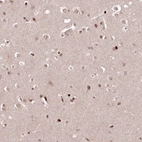 Immunohistochemical staining of human cerebral cortex shows moderate nuclear positivity in glial cells.