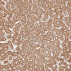 Immunohistochemical staining of human liver shows moderate granular positivity in cytoplasm in hepatocytes.