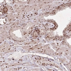 Immunohistochemical staining of human prostate shows moderate to strong nuclear positivity in smooth muscle cells and glandular cells.