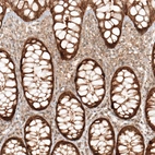 Immunohistochemical staining of human rectum shows strong granular positivity in cytoplasm in glandular cells.