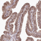 Immunohistochemical staining of human Fallopian tube shows strong nuclear positivity in glandular cells.