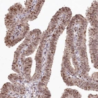 Immunohistochemical staining of human Fallopian tube shows strong nuclear positivity in glandular cells.