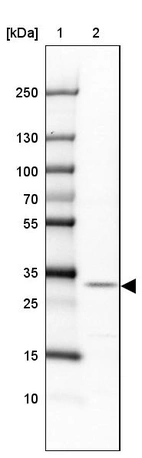 Lane 1: Marker [kDa] 250, 130, 100, 70, 55, 35, 25, 15, 10_br/_Lane 2: Human cell line SK-MEL-30