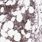 Anti-ZCCHC8 Antibody