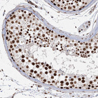 Immunohistochemical staining of human testis shows strong nuclear positivity in cells in seminiferous ducts.