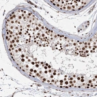 Immunohistochemical staining of human testis shows strong nuclear positivity in cells in seminiferous ducts.