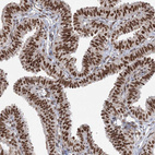 Immunohistochemical staining of human fallopian tube show strong nuclear positivity in glandular cells.