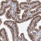 Anti-ZCCHC8 Antibody