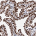 Immunohistochemical staining of human fallopian tube show strong nuclear positivity in glandular cells.