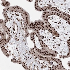 Immunohistochemical staining of human placenta shows strong nuclear positivity in trophoblastic cells.