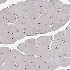 Immunohistochemical staining of human skeletal muscle shows strong nuclear positivity in myocytes.