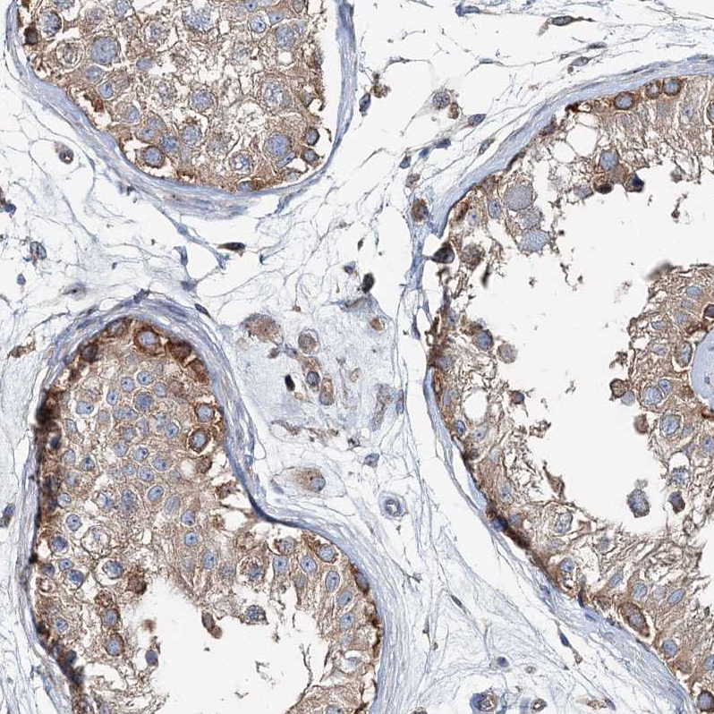 Anti-MPHOSPH9 Antibody