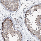 Anti-MPHOSPH9 Antibody