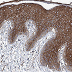 Immunohistochemical staining of human skin shows strong cytoplasmic positivity in squamous epithelial cells.