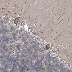 Immunohistochemical staining of human cerebellum shows strong cytoplasmic positivity in Purkinje cells.