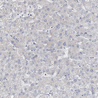 Immunohistochemical staining of human liver shows no positivity in hepatocytes as expected.