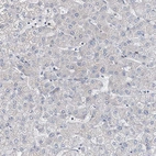 Immunohistochemical staining of human liver shows no positivity in hepatocytes as expected.