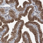 Immunohistochemical staining of human Fallopian tube shows moderate to strong nuclear positivity in glandular cells.