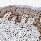 Immunohistochemical staining of human skin shows moderate to strong nuclear positivity in squamous epithelial cells.