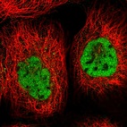 Immunofluorescent staining of human cell line A-431 shows localization to nucleoplasm.