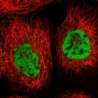 Immunofluorescent staining of human cell line A-431 shows localization to nucleoplasm.