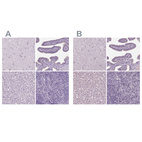 Immunohistochemical staining of human cerebral cortex, fallopian tube, liver and lymph node using Anti-DNAH12 antibody HPA037493 (A) shows similar protein distribution across tissues to independent antibody HPA058203 (B).