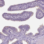 Immunohistochemical staining of human fallopian tube shows moderate positivity in ciliated cells.