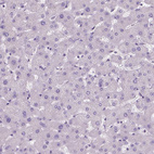 Immunohistochemical staining of human liver shows no positivity in hepatocytes as expected.