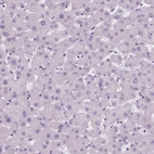 Immunohistochemical staining of human liver shows no positivity in hepatocytes as expected.