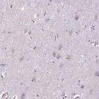 Immunohistochemical staining of human cerebral cortex shows no positivity in neurons as expected.