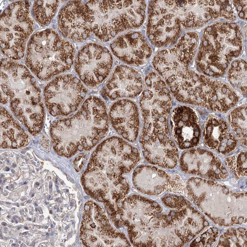 Anti-CBR4 Antibody
