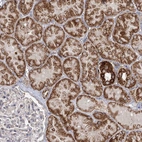 Anti-CBR4 Antibody