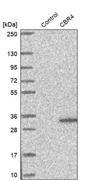 Western blot analysis in control (vector only transfected HEK293T lysate) and CBR4 over-expression lysate (Co-expressed with a C-terminal myc-DDK tag (~3.1 kDa) in mammalian HEK293T cells, LY409926).