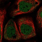 Immunofluorescent staining of human cell line A-431 shows localization to nucleoplasm.
