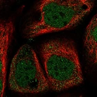 Immunofluorescent staining of human cell line A-431 shows localization to nucleoplasm.