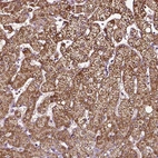 Immunohistochemical staining of human liver shows strong granular cytoplasmic positivity in hepatocytes.