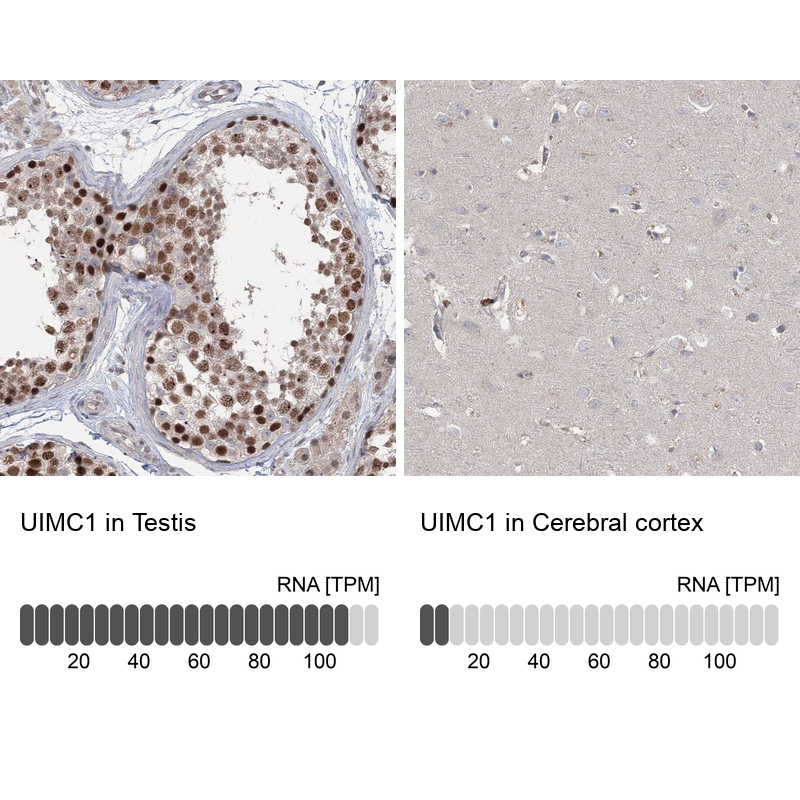 Anti-UIMC1 Antibody
