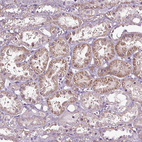 Immunohistochemical staining of human kidney shows weak granular cytoplasmic positivity in cells in tubules.