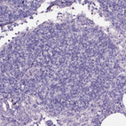 Immunohistochemical staining of human lymph node shows no positivity in non-germinal center cells as expected.