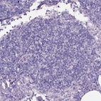 Immunohistochemical staining of human lymph node shows no positivity in non-germinal center cells as expected.