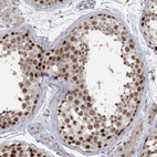 Immunohistochemical staining of human testis shows strong nuclear positivity in cells in seminiferous ducts.