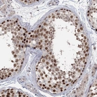 Immunohistochemical staining of human testis shows strong nuclear positivity in cells in seminiferous ducts.