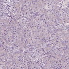 Immunohistochemical staining of human pancreas shows no positivity in exocrine glandular cells as expected.