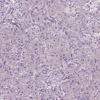 Immunohistochemical staining of human pancreas shows no positivity in exocrine glandular cells as expected.