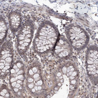 Immunohistochemical staining of human colon shows moderate nuclear positivity in glandular cells.