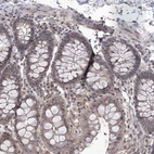 Immunohistochemical staining of human colon shows moderate nuclear positivity in glandular cells.