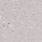 Immunohistochemical staining of human cerebral cortex shows no positivity in neurons as expected.