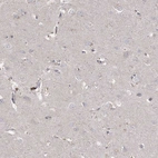 Immunohistochemical staining of human cerebral cortex shows no positivity in neurons as expected.
